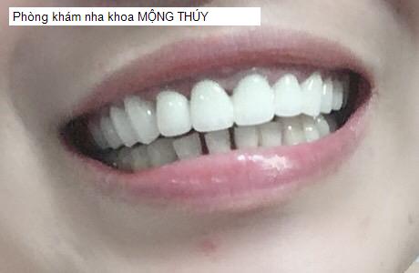 Hình ảnh Phòng khám nha khoa MỘNG THÚY